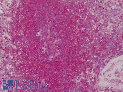 Anti-Tropomyosin 1 antibody IHC of human spleen. Immunohistochemistry of formalin-fixed, paraffin-embedded tissue after heat-induced antigen retrieval. Antibody LS-B4800 concentration 10 ug/ml.