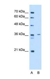 Lane A: Marker. Lane B: HepG2 cell lysate. Antibody concentration: 2.5 ug/ml. Gel concentration: 12%.