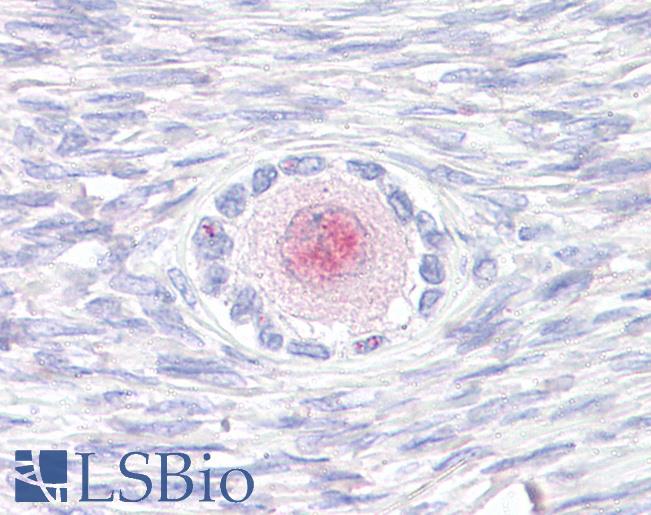 Anti-TM9SF4 antibody LS-A9237 IHC of human, ovary. Immunohistochemistry of formalin-fixed, paraffin-embedded tissue after heat-induced antigen retrieval.