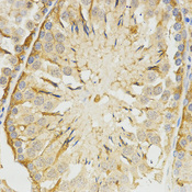 Immunohistochemistry of paraffin-embedded rat testis tissue using TPM2 antibody at dilution of 1:200 (x400 lens).