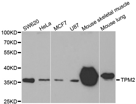 Western blot analysis of extracts of various cell lines, using TPM2 antibody.