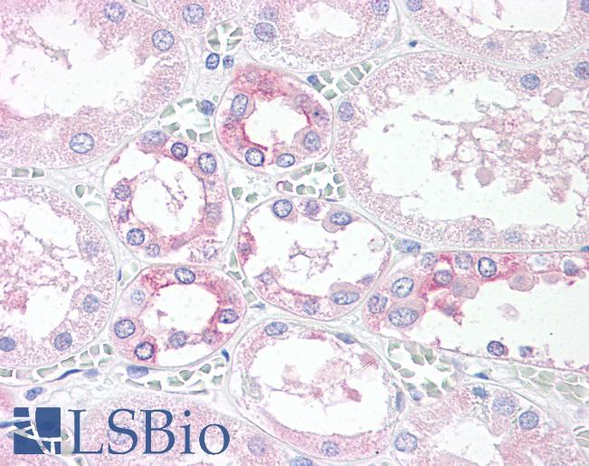 Anti-TM9SF4 antibody LS-A9237 IHC of human, kidney. Immunohistochemistry of formalin-fixed, paraffin-embedded tissue after heat-induced antigen retrieval.