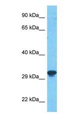 Western blot of TPM4 Antibody with human MCF7 Whole Cell lysate.