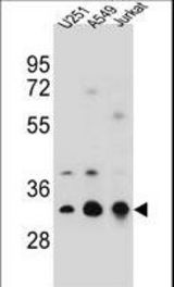 TPM4 Antibody western blot of U251,A549,Jurkat cell line lysates (35 ug/lane). The TPM4 antibody detected the TPM4 protein (arrow).
