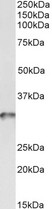 TPM4 antibody (0.03 ug/ml) staining of Human Platelets lysate (35 ug protein in RIPA buffer). Primary incubation was 1 hour. Detected by chemiluminescence.