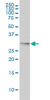 TPM4 monoclonal antibody (M01), clone 4E4-1D2 Western blot of TPM4 expression in HeLa.