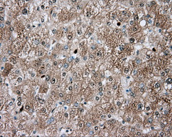 IHC of paraffin-embedded liver tissue using anti-TPMT mouse monoclonal antibody. (Dilution 1:50).