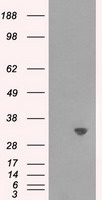 HEK293T cells were transfected with the pCMV6-ENTRY control (Left lane) or pCMV6-ENTRY TPMT (Right lane) cDNA for 48 hrs and lysed. Equivalent amounts of cell lysates (5 ug per lane) were separated by SDS-PAGE and immunoblotted with anti-TPMT.