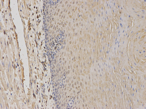 Immunohistochemistry of paraffin-embedded human esophagus using TPMT antibody at dilution of 1:100 (200x lens).