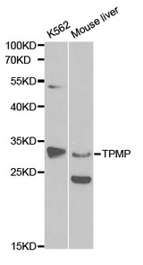 Western blot analysis of extracts of various cell lines, using TPMT antibody.