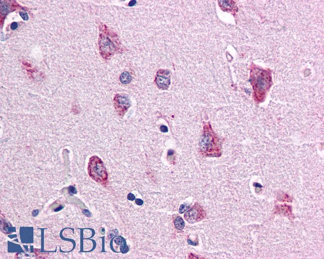 Anti-TM9SF4 antibody LS-A9852 IHC of human brain, cortex. Immunohistochemistry of formalin-fixed, paraffin-embedded tissue after heat-induced antigen retrieval.