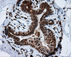 IHC of paraffin-embedded breast tissue using anti-TPMT mouse monoclonal antibody. (Dilution 1:50).