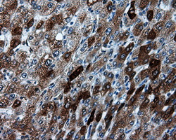 IHC of paraffin-embedded liver tissue using anti-TPMT mouse monoclonal antibody. (Dilution 1:50).