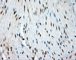 IHC of paraffin-embedded colon tissue using anti-TPMT mouse monoclonal antibody. (Dilution 1:50).
