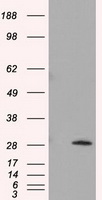 HEK293T cells were transfected with the pCMV6-ENTRY control (Left lane) or pCMV6-ENTRY TPMT (Right lane) cDNA for 48 hrs and lysed. Equivalent amounts of cell lysates (5 ug per lane) were separated by SDS-PAGE and immunoblotted with anti-TPMT.