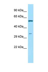 TPMT antibody LS-C146543 Western blot of 3 Cell lysate. Antibody concentration 1 ug/ml.