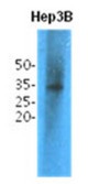 Western Blot: The cell lysates (40 ug) were resolved by SDS-PAGE, transferred to PVDF membrane and probed with anti-human TPMT antibody (1:1,000). Proteins were visualized using a goat anti-mouse secondary antibody conjugated to HRP and an ECL detection system.