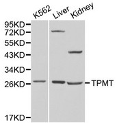 Western blot of TPMT pAb in extracts from K562 cells and mouse liver, kidney tissues.