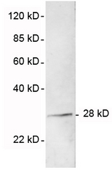 Western blot of recombinant human TPMT protein using 1 ug/ml Rabbit Anti-TPMT Polyclonal Antibody. The signal was developed with IRDye 800 Conjugated Goat Anti-Rabbit IgG.