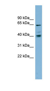 TM9SF4 antibody LS-C107955 Western blot of NCI-H226 cell lysate.