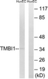 Western blot of extracts from HUVEC cells, using TMBIM1 Antibody. The lane on the right is treated with the synthesized peptide.