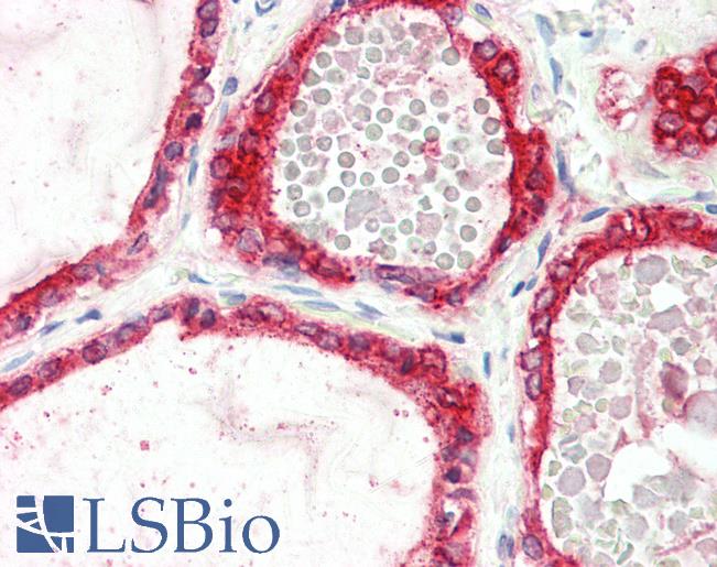 Anti-TPO / Thyroid Peroxidase antibody IHC staining of human thyroid. Immunohistochemistry of formalin-fixed, paraffin-embedded tissue after heat-induced antigen retrieval. Antibody LS-B10336 concentration 5 ug/ml.