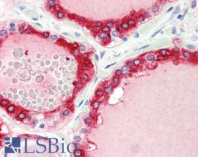 Anti-TPO / Thyroid Peroxidase antibody IHC staining of human thyroid. Immunohistochemistry of formalin-fixed, paraffin-embedded tissue after heat-induced antigen retrieval. Antibody LS-B10456 concentration 5 ug/ml.