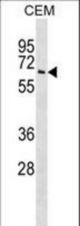 TPP1 Antibody western blot of CEM cell line lysates (35 ug/lane). The TPP1 antibody detected the TPP1 protein (arrow).