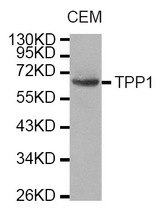 Western blot analysis of extracts of CEM cell line, using TPP1 antibody.