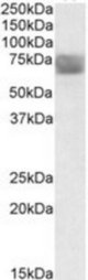 TPP1 antibody (0.3 ug/ml) staining of Human Placenta lysate (35 ug protein/ml in RIPA buffer) with (B) and without (A) blocking with the immunizing peptide. Primary incubation was 1 hour. Detected by chemiluminescence.