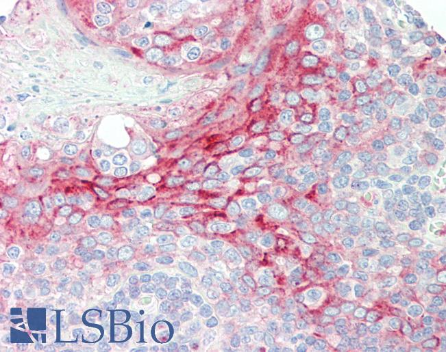 Anti-TMBIM1 antibody IHC staining of human tonsil. Immunohistochemistry of formalin-fixed, paraffin-embedded tissue after heat-induced antigen retrieval.