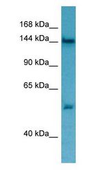 TPP2 antibody Western Blot of Jurkat.