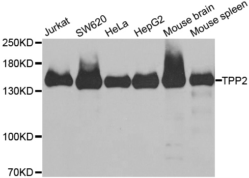 Western blot analysis of extracts of various cell lines, using TPP2 antibody.