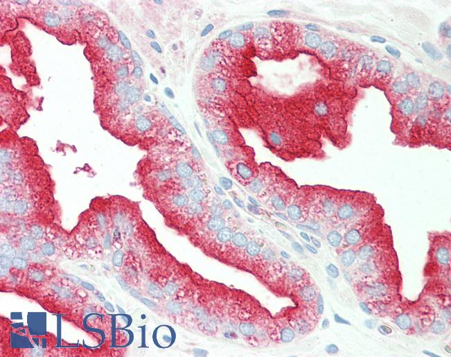 Anti-TMBIM1 antibody IHC staining of human prostate. Immunohistochemistry of formalin-fixed, paraffin-embedded tissue after heat-induced antigen retrieval. Antibody LS-B10596 concentration 10 ug/ml.