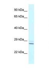 TPPP antibody LS-C145510 Western blot of Fetal Liver lysate. Antibody concentration 1 ug/ml.