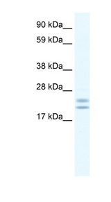 TPPP antibody LS-C30616 Western blot of Frontal cortex lysate.