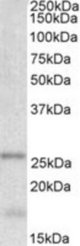 TPPP antibody (0.001 ug/ml) staining of Human Cerebellum lysate (35 ug protein/ml in RIPA buffer). Primary incubation was 1 hour. Detected by chemiluminescence.