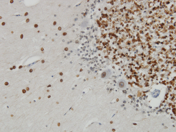 Immunoperoxidase of monoclonal antibody to TPR on formalin-fixed paraffin-embedded human cerebellum. [antibody concentration 3 ug/ml]