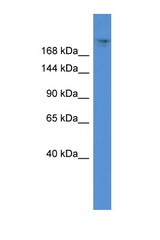 TPR antibody LS-C135923 Western blot of 721_B Cell lysate. Antibody concentration 1 ug/ml.