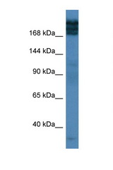 TPR antibody LS-C135922 Western blot of Fetal Lung lysate. Antibody concentration 1 ug/ml.