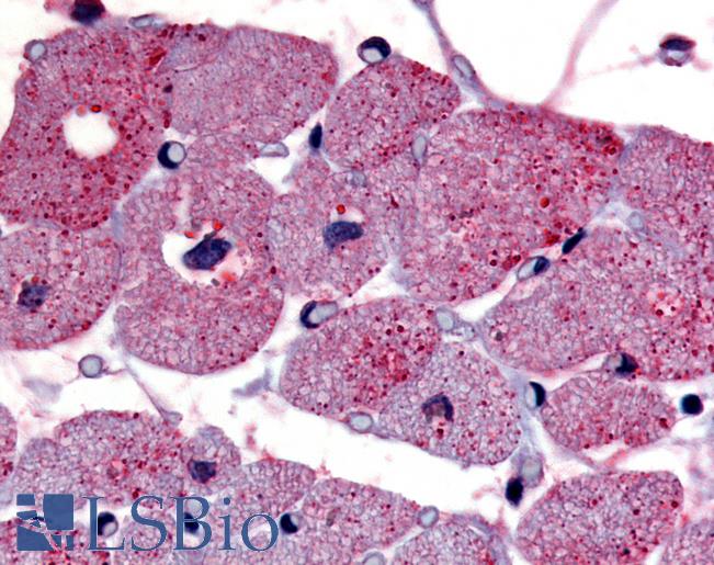Anti-TPRA1 / GPR175 antibody LS-A1525 IHC of human cardiac myocytes. Immunohistochemistry of formalin-fixed, paraffin-embedded tissue after heat-induced antigen retrieval.