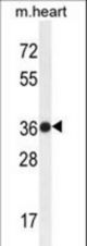TMBIM4 Antibody western blot of mouse heart tissue lysates (35 ug/lane). The TMBIM4 antibody detected the TMBIM4 protein (arrow).