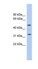 TPRG1 antibody LS-C135361 Western blot of Placenta lysate.