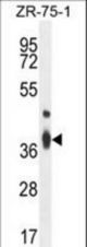 TMBIM4 Antibody western blot of ZR-75-1 cell line lysates (35 ug/lane). The TMBIM4 antibody detected the TMBIM4 protein (arrow).