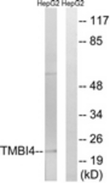 Western blot of extracts from HepG2 cells, using TMBIM4 Antibody. The lane on the right is treated with the synthesized peptide.