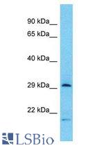 TPSB2 / Tryptase Beta 2 antibody Western Blot of HT1080. Antibody dilution: 1 ug/ml.
