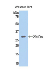 Western blot of recombinant TPSB2 / Tryptase Beta 2.
