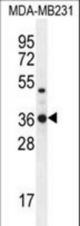 TPSD1 Antibody western blot of MDA-MB231 cell line lysates (35 ug/lane). The TPSD1 antibody detected the TPSD1 protein (arrow).