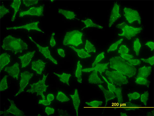 Immunofluorescence of monoclonal antibody to TPT1 on HeLa cell. [antibody concentration 30 ug/ml]