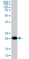 TPT1 monoclonal antibody (M01), clone 3C7 Western Blot analysis of TPT1 expression in HepG2.